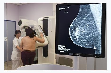 Cancer du sein : la mammographie 3D recommandée dans le cadre du dépistage