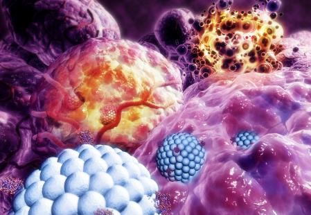 Des médicaments en surface de nanoparticules chargées de détruire une tumeur cancéreuse