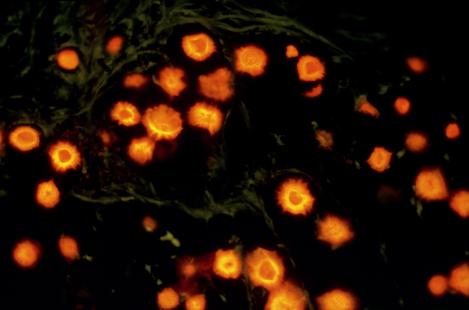 Cryptococcus neoformans, levure capsulée, provoque dans le cerveau une infection appelée cryptococcose entraînant une méningo-encéphalite